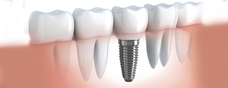 emergency dentistry