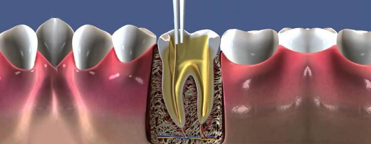 emergency dentistry